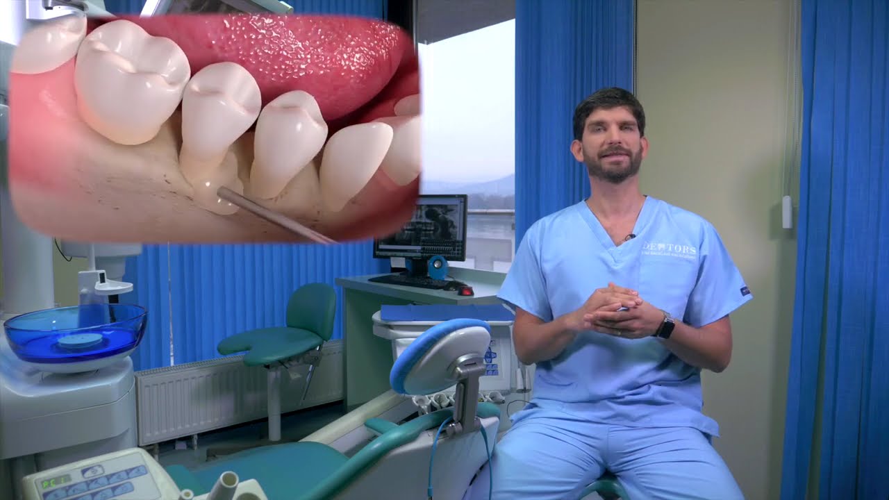 Ínysorvadás és a fogágybetegség megállítása parodontológiai kezeléssel | Dentors parodontológia