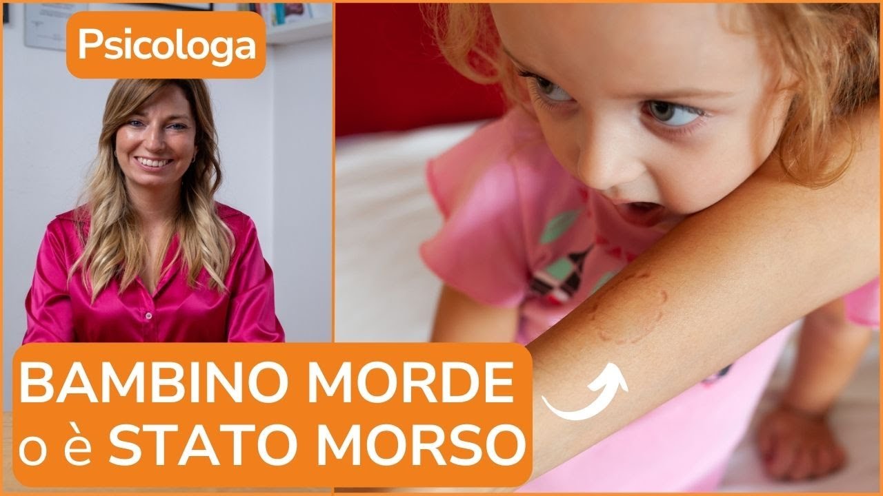 BAMBINO MORDE o è STATO MORSO: ecco cosa fare - Le risposte della Psicologa