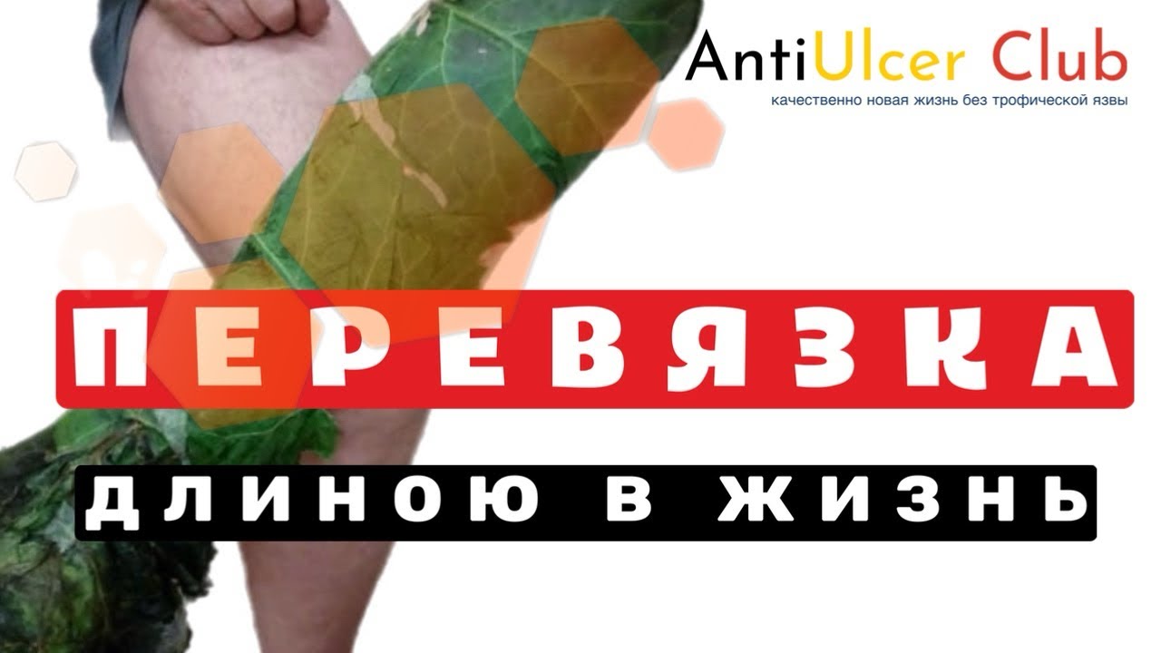 У всех пациентов с трофическими язвами примерно одна и та же история. Грустно