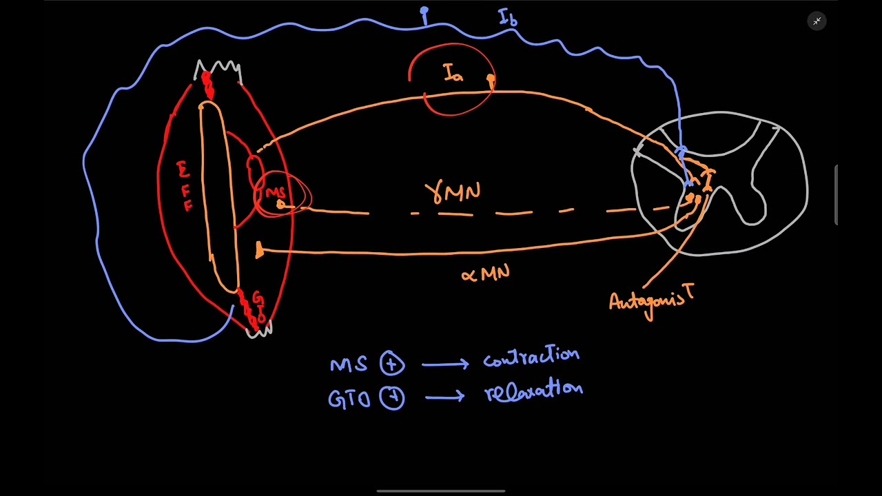 Motor neuron signs | Neurology # 17 | First Aid USMLE in Urdu/Hindi