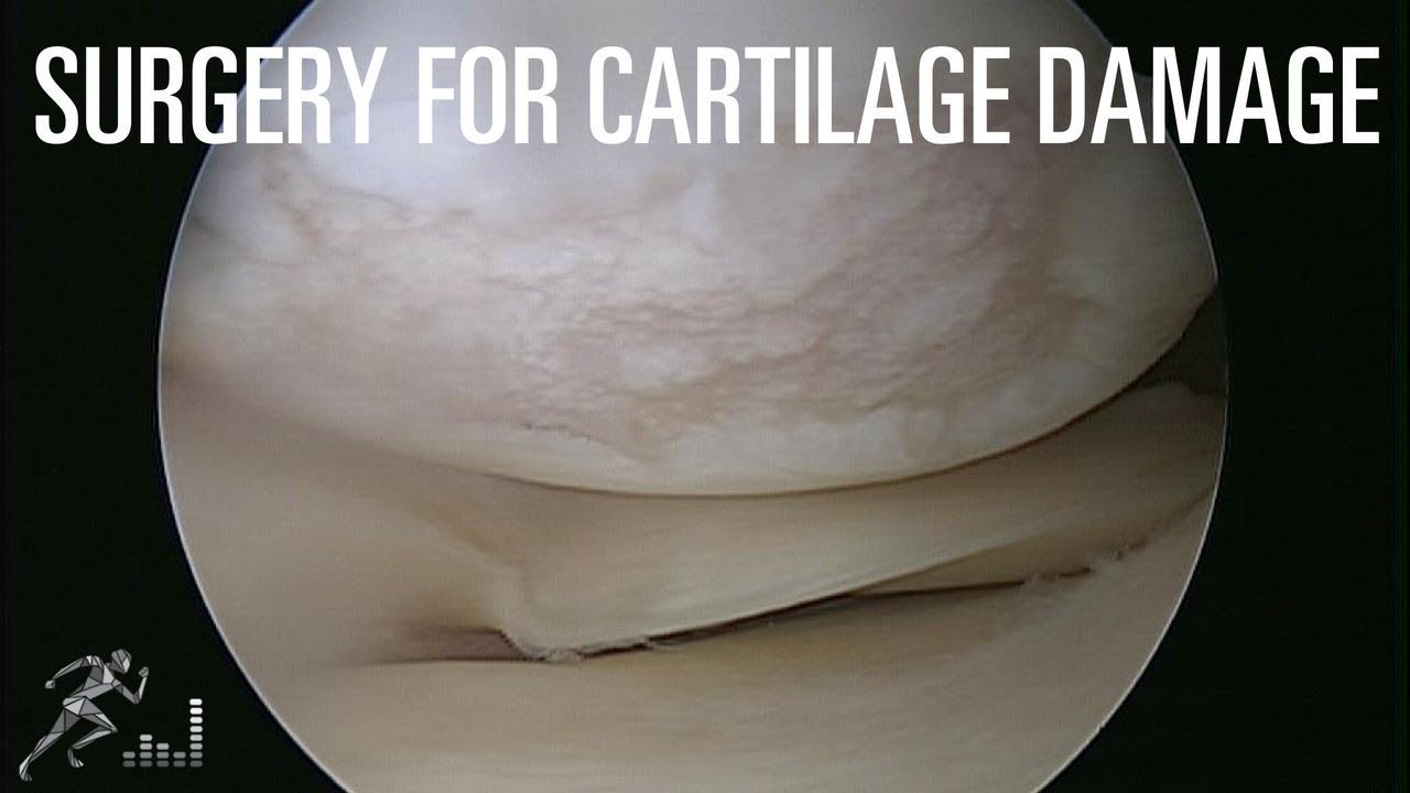 Should you have surgery for a small area of cartilage damage?