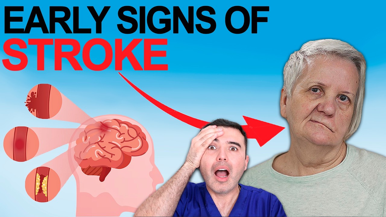 You’re CAUSING a STROKE Without Knowing It: 5 Daily Habits DESTROYING Your Brain