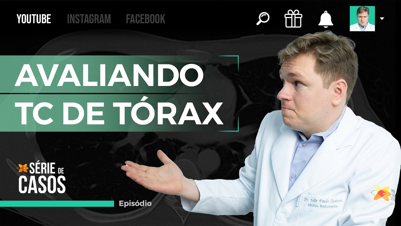 O QUE TODO MÉDICO GENERALISTA PRECISA SABER AVALIAR NUMA TC DE TÓRAX