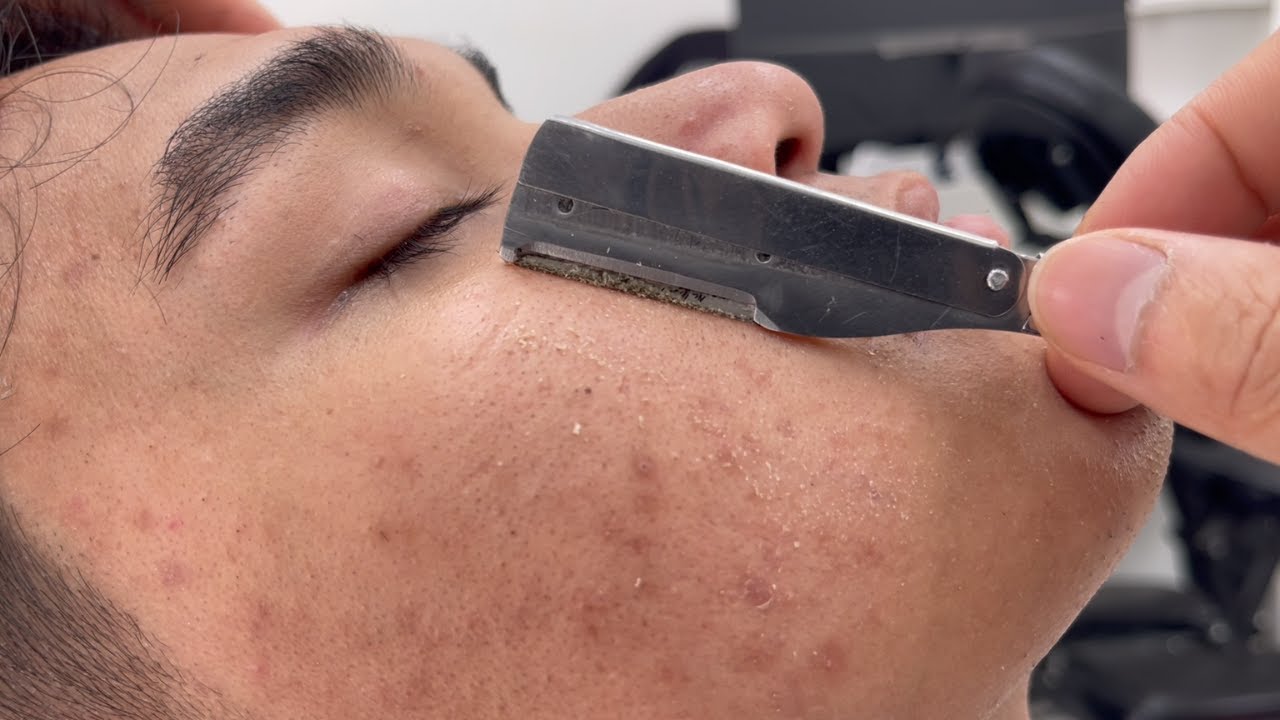 ASMR 🦓 FOR A GOOD SLEEP | REMOVES A LOT OF DEAD SKIN CELLS FROM THE FACE | SHAVING ASMR EP542