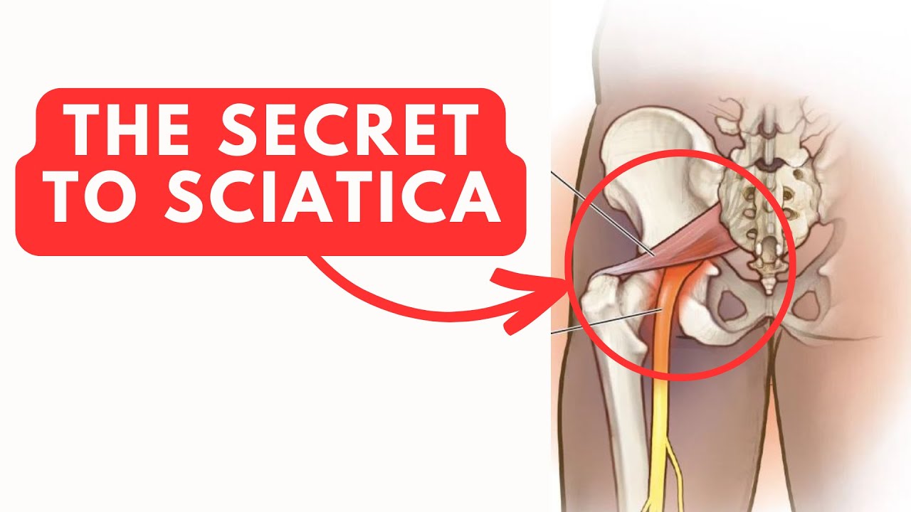 You've Never Tried This Fix For Sciatica & Piriformis Pain