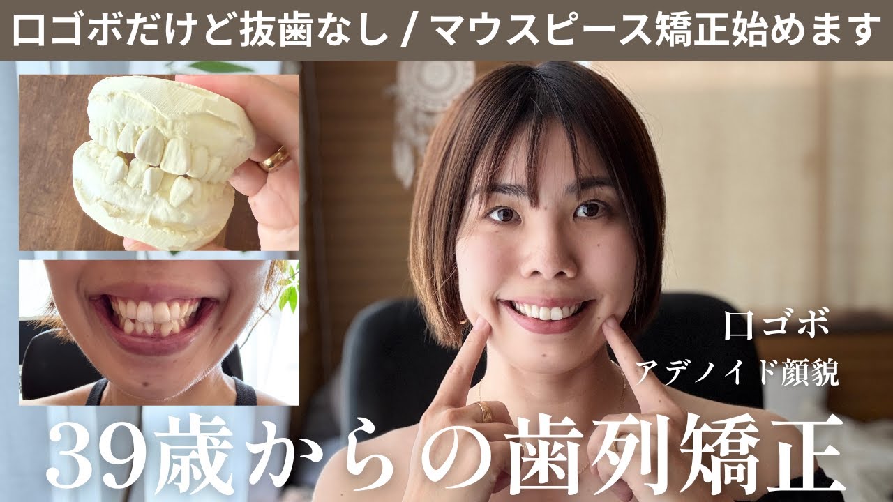 【歯列矯正】39歳から始めます｜後戻りからのセルフマウスピース矯正に踏み切る２児の母