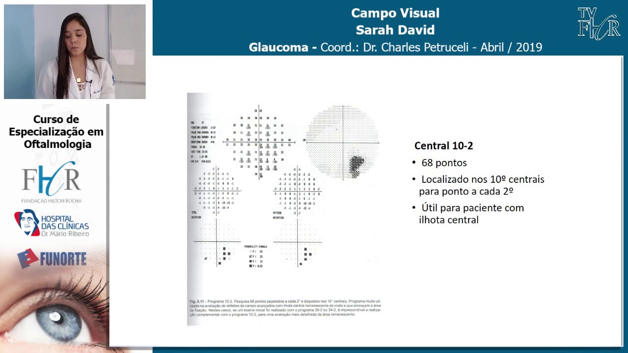 Campo Visual - Sarah David - Glaucoma