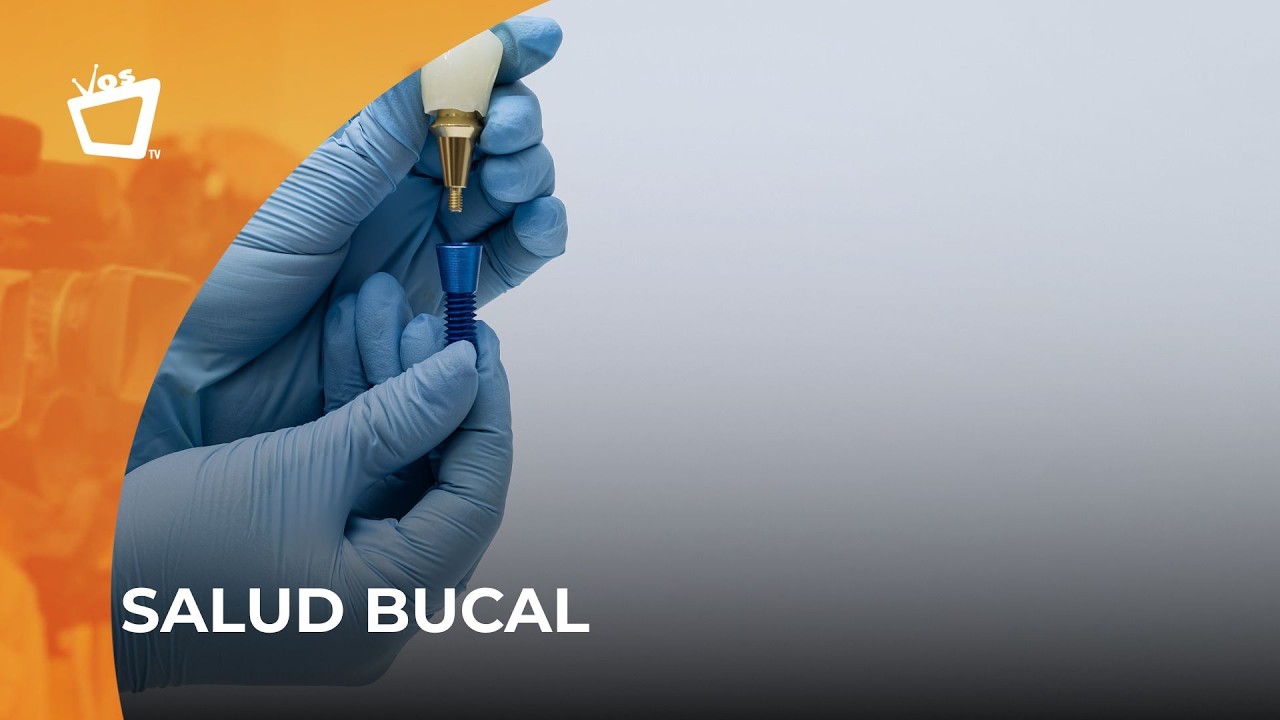 ¿Cómo saber si necesitás implantes dentales? | Parte dos