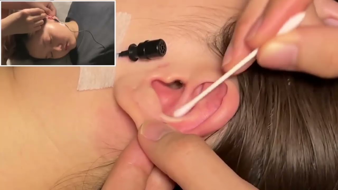 ASMR Authentic Ear Cleaning – Pure Tingles Guaranteed #earcleaning #earcleaningasmr #earwaxremoval
