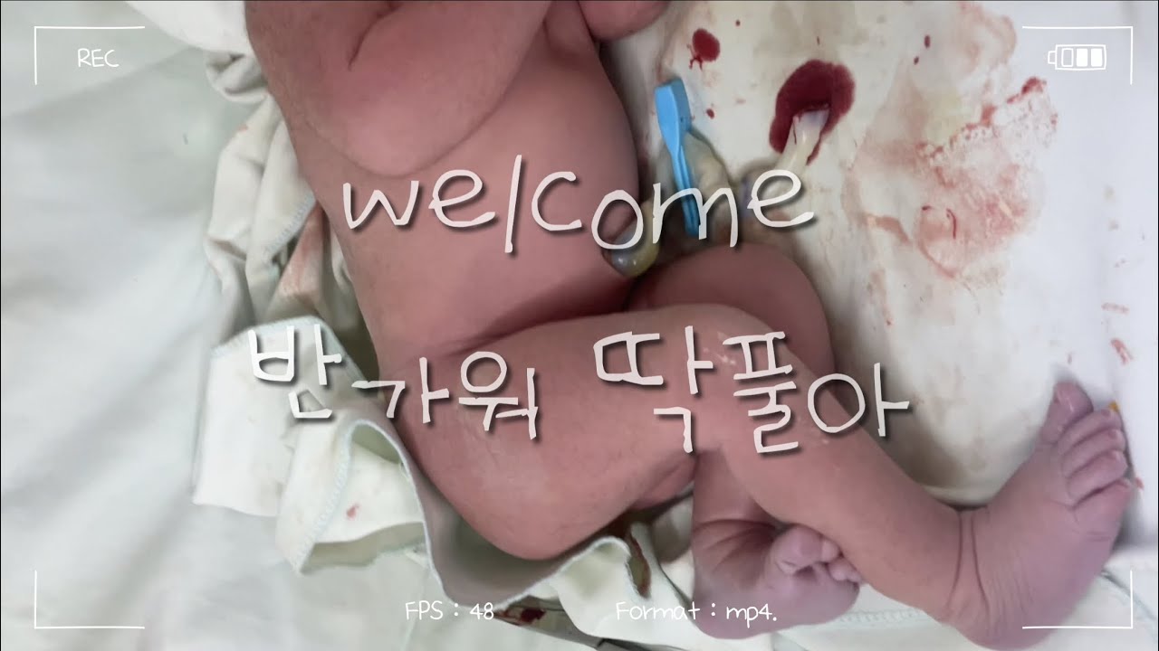 너를 처음 만난 날의 기록. 250214 👶🏻 welcome 딱풀!