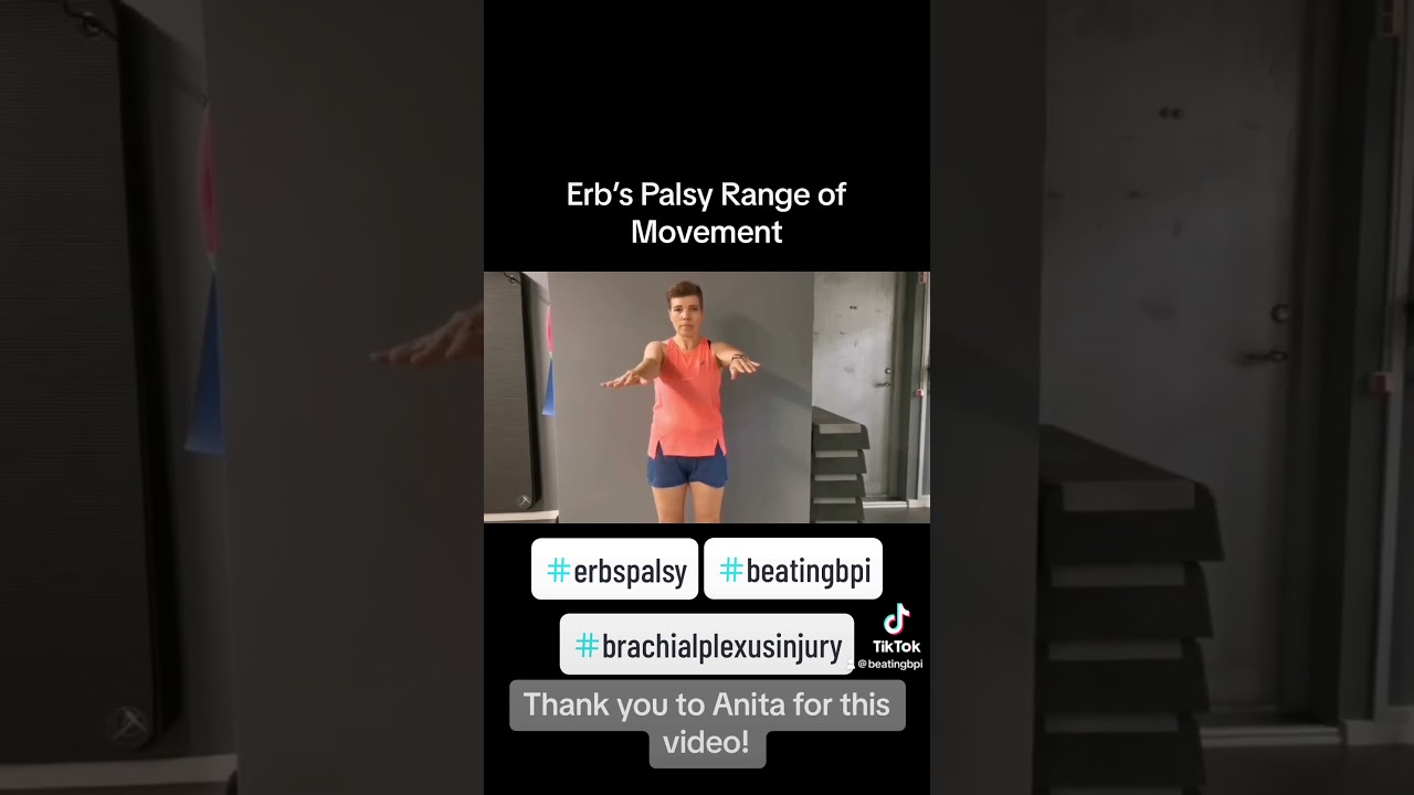 Range of movement with #erbspalsy #brachialplexusinjury (Video 1)
