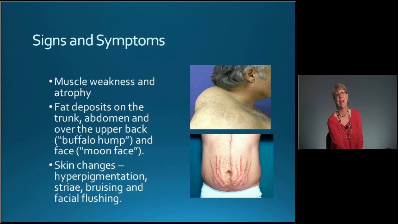 Medical-Surgical Nursing Exam Review: Endocrine Disorders - MED-ED