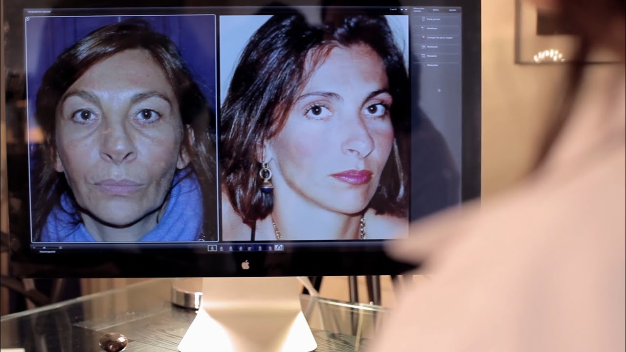 Chirurgie esthétique des paupières - Consultation chez le Dr Natalie Rajaonarivelo