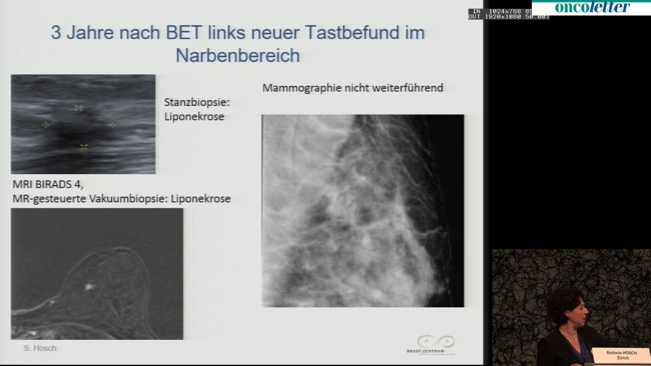 Dr. med. Stefanie Hosch, Brust-Zentrum, Z&uuml;rich: