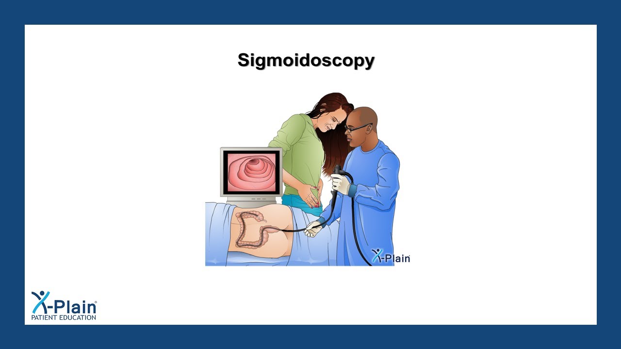Sigmoidoscopy