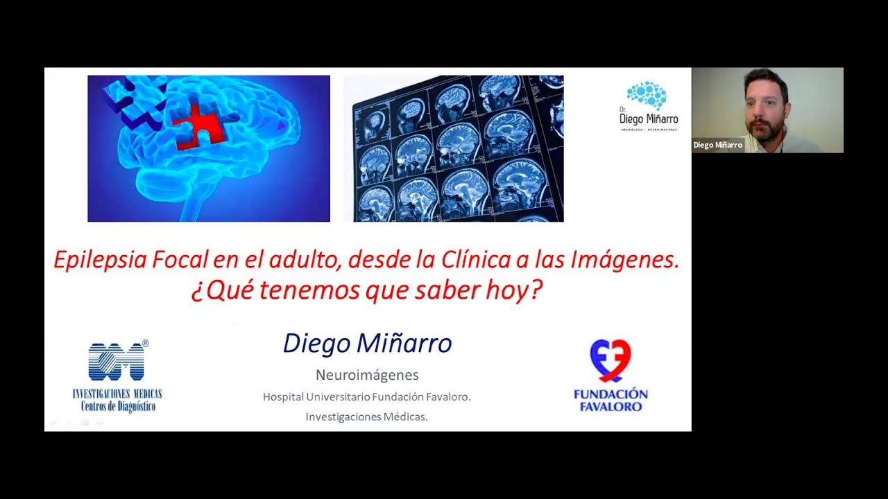 Charla “Epilepsia focal del adulto desde la clínica a las imágenes. ¿Qué tenemos que saber hoy?”