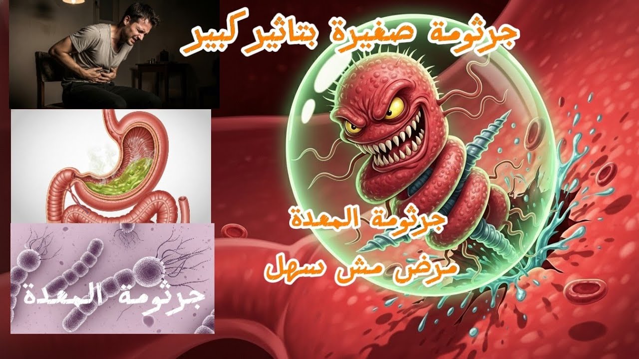 جرثومة المعدة ممكن تدمر معدتك لو لم تعالج مبكرا😱😱