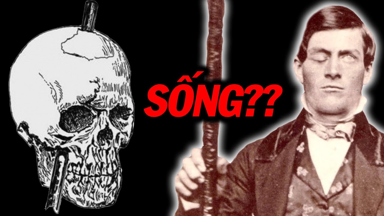 5 Người Sống Sót Thần Kỳ Qua Đại Nạn Không Sách Vở Nào Có Thể Giải Thích!!