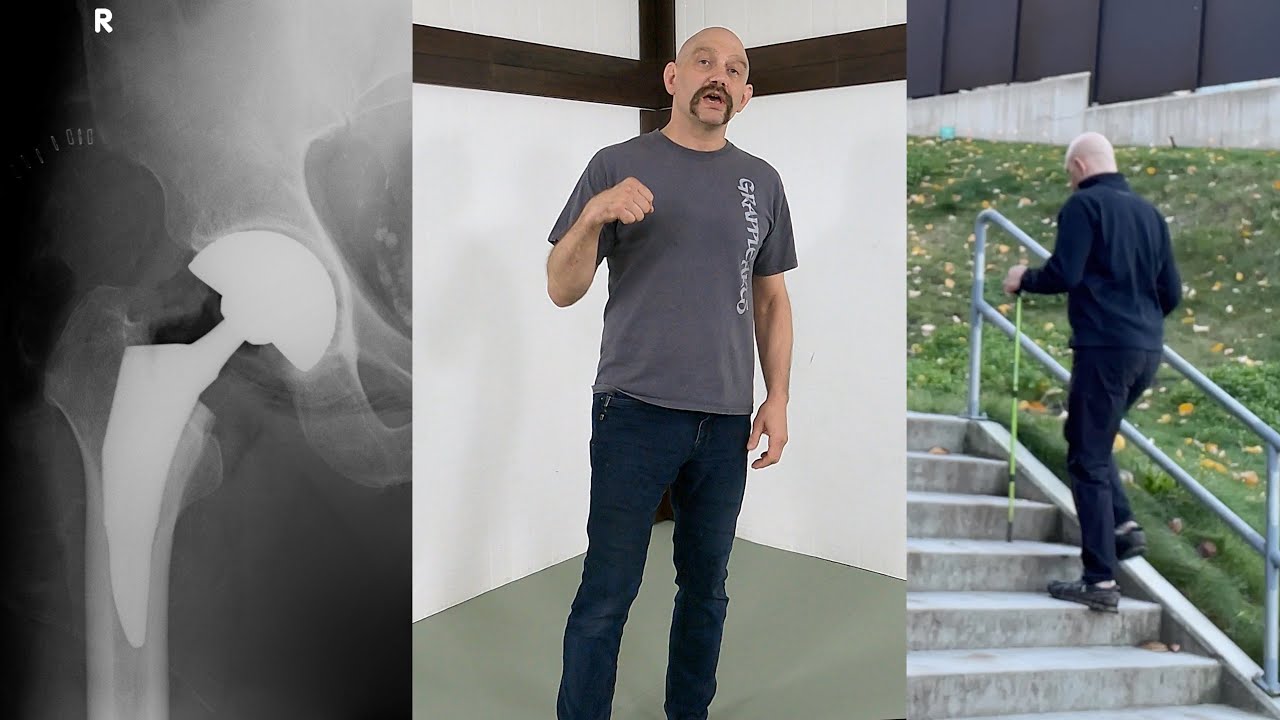 Part 2: Hip Replacement after 40 years of BJJ, MMA, and Martial Arts Training - The First Four Weeks