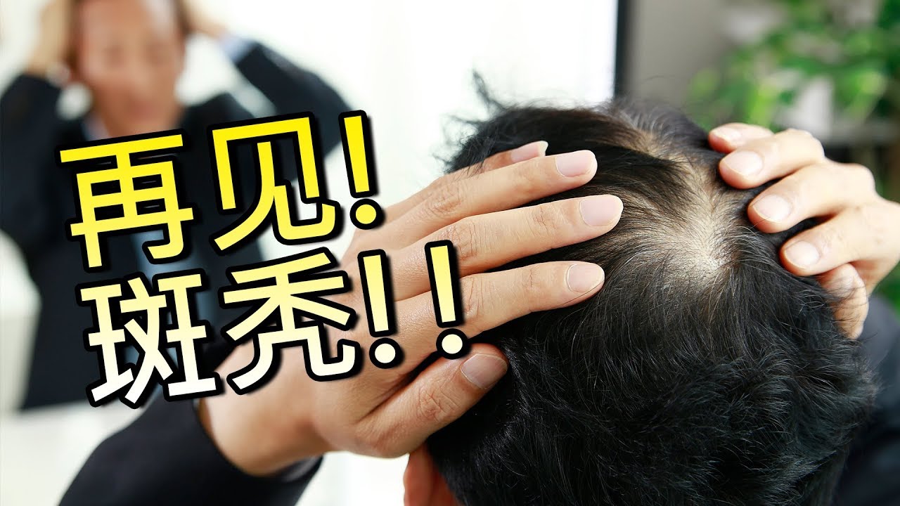 再见！斑秃