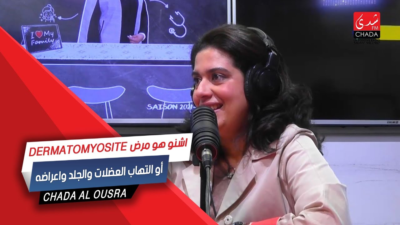 أشنو هو مرض Dermatomyosite أو إلتهاب العضلات و الجلد و أعراضه