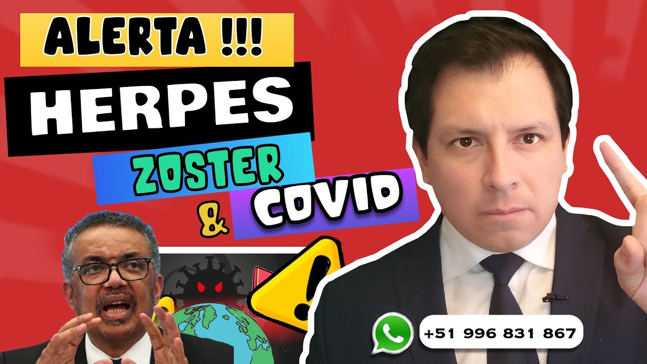 ALERTA⚠️ INVESTIGACION REVELA ASOCIACIÓN DE COVID-19 Y HERPES ZOSTER