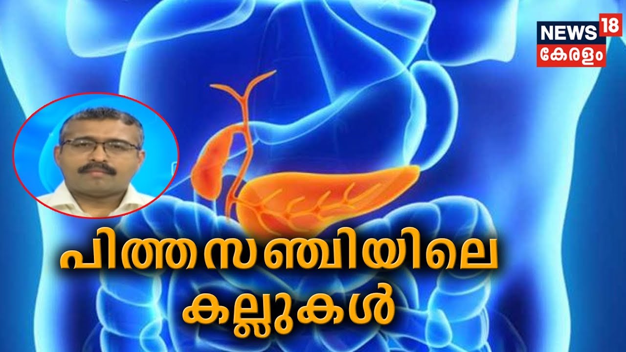 Dr Q : പിത്തസഞ്ചിയിലെ കല്ലുകള്‍ | Gall-Bladder Stone |  27th May 2019