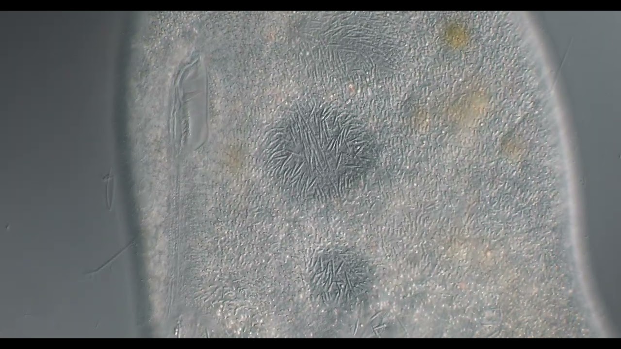 Ciliate frontonia  400x