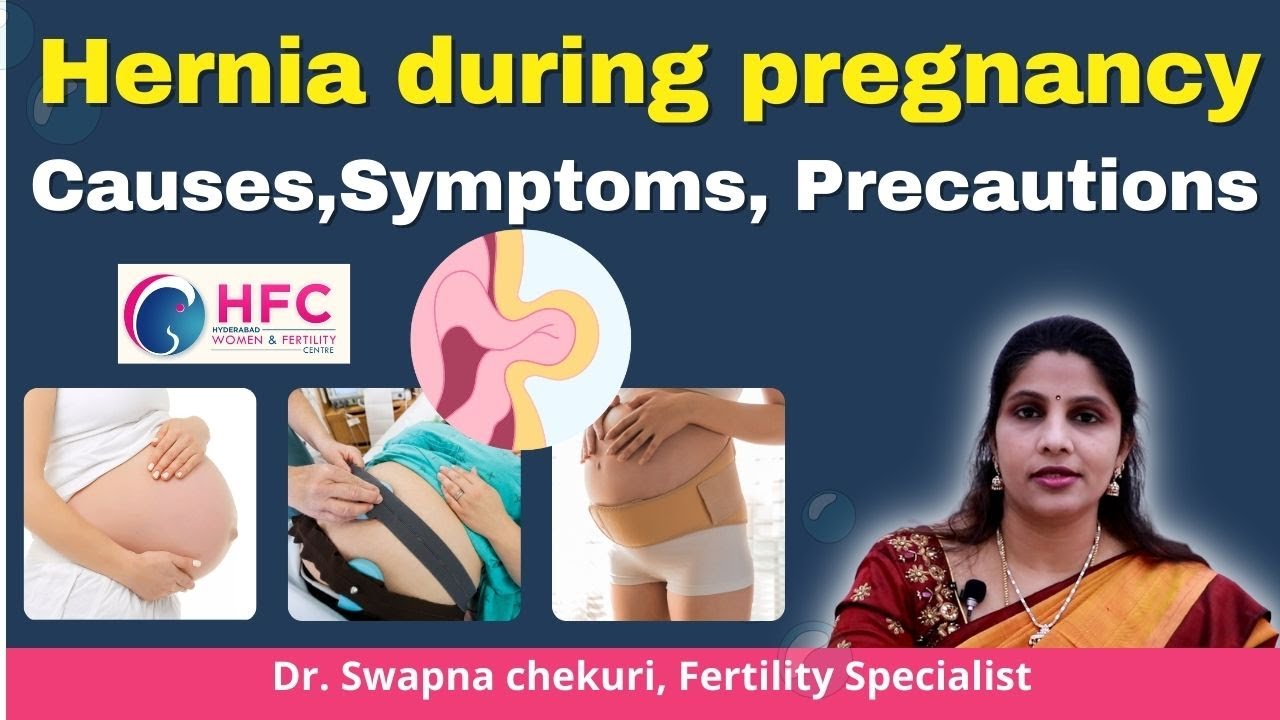 Umbilical Hernia During Pregnancy: Causes, Symptoms, and Management || HFC