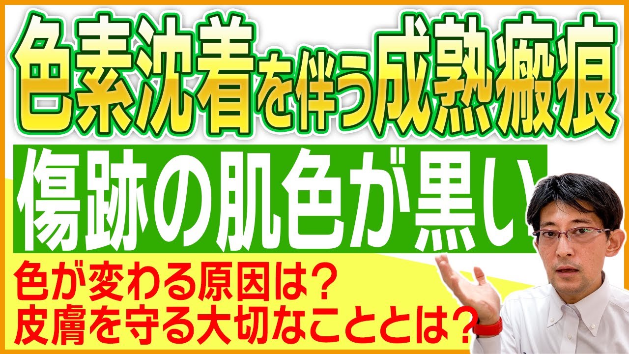 黒くなってしまった傷跡は治せる？(色素沈着を伴う成熟瘢痕) 形成外科きずときずあとのクリニックでの治療内容を院長が解説！【皮膚を守る大切な事とは？】