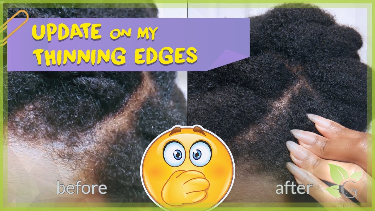 UPDATE on my THINNING EDGES