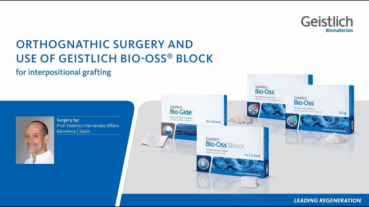 Orthognathic surgery and use of Geistlich Bio-Oss&reg; Block for interpositional grafting