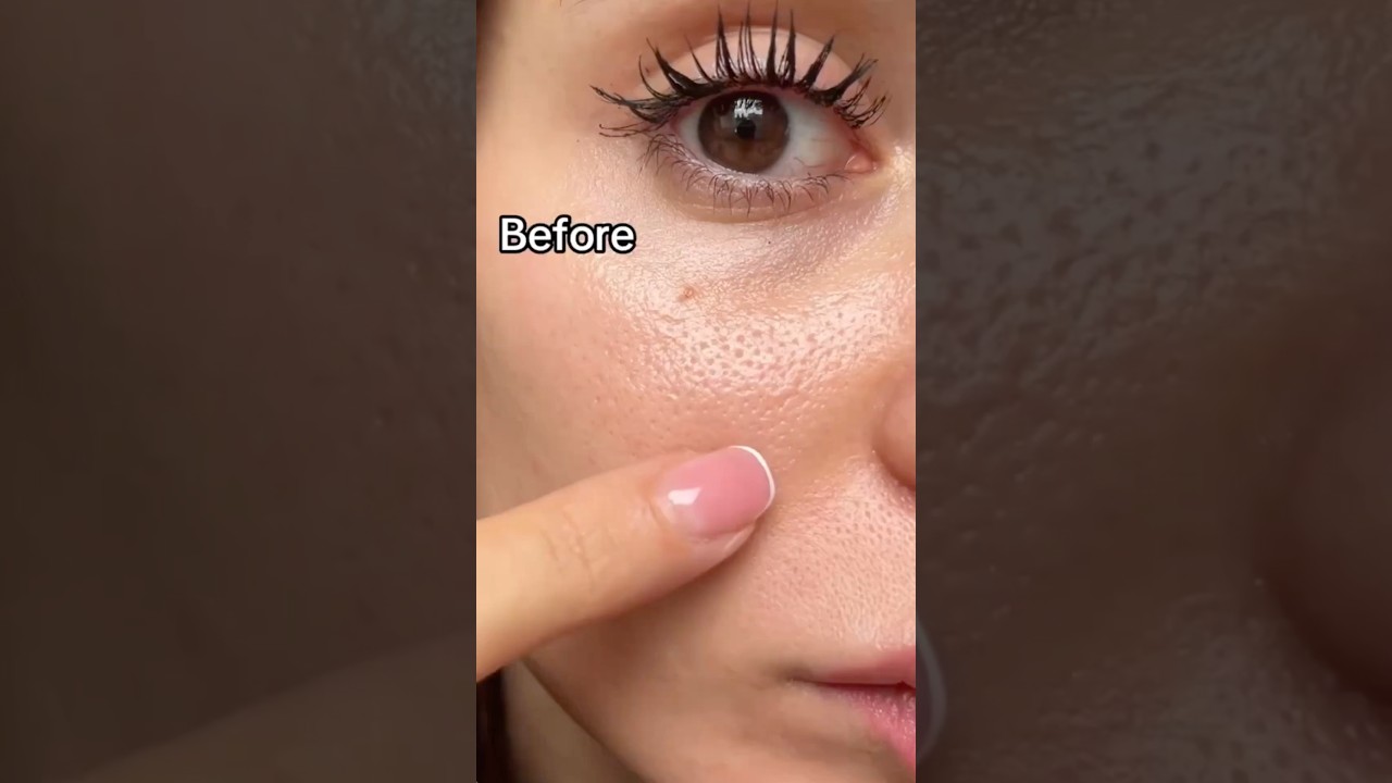 Best Open Pores Home Remedy | Open Pores Treatment At Home #shorts #skincare