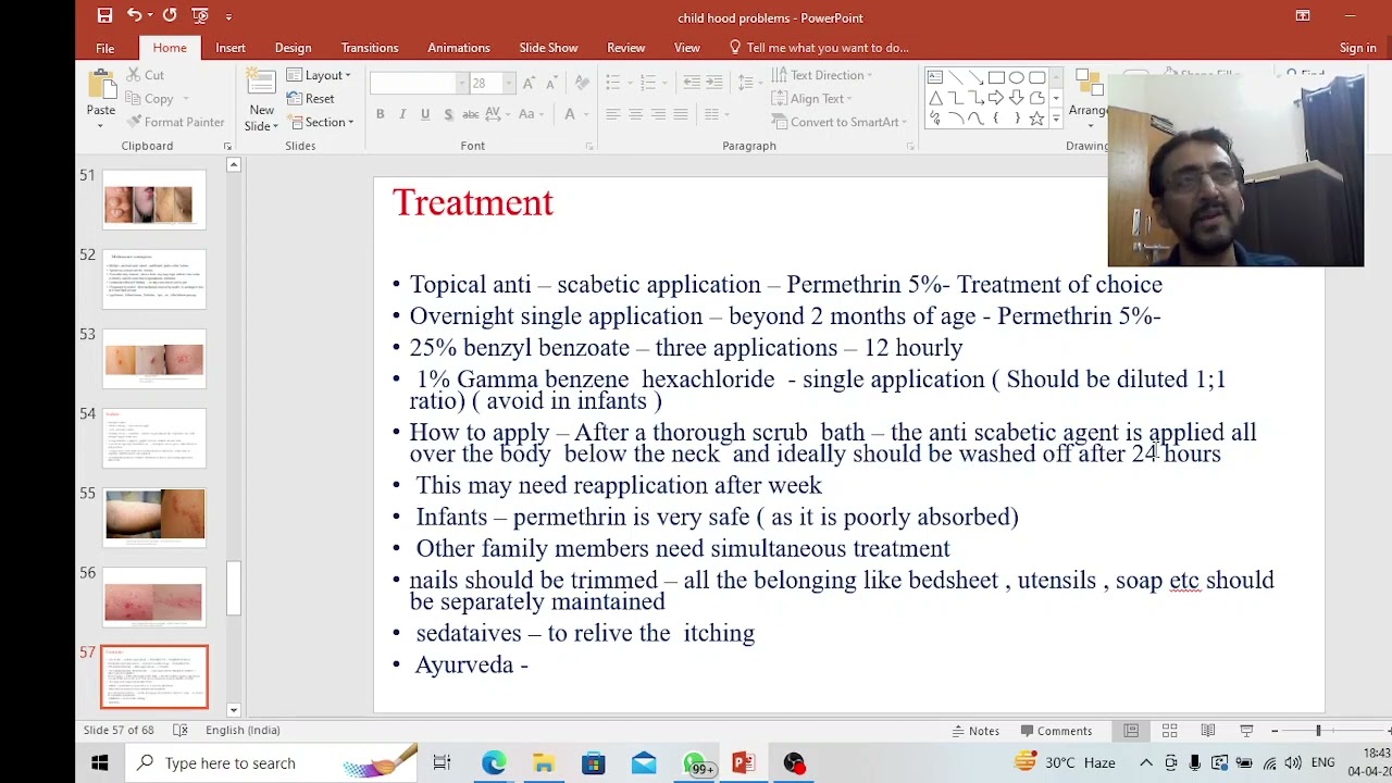 How to treat Scabies in Ayurveda - Common childhood skin problems -Part 3