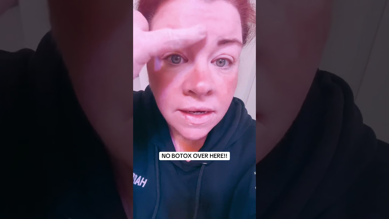 This Skin Gym Face Tape is a 10/10 and that is it!! I will now never need Botox! On sale now in the
