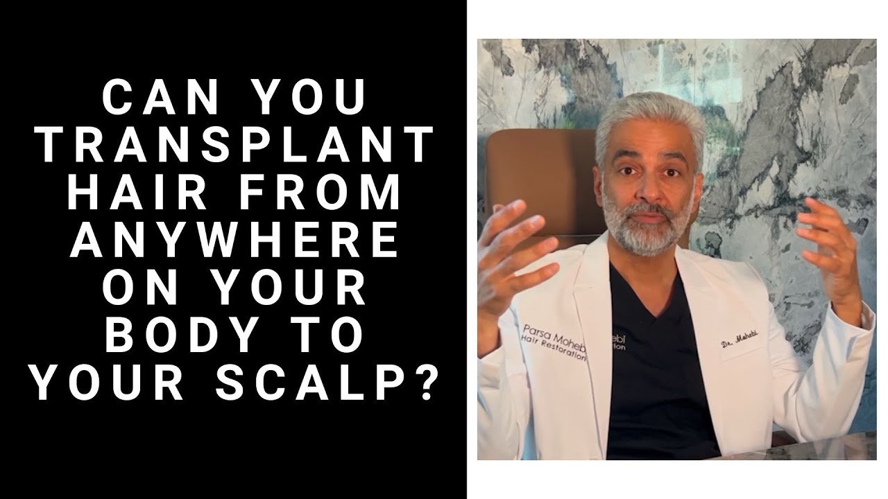 Can you Transplant from anywhere on your Body to your Scalp?