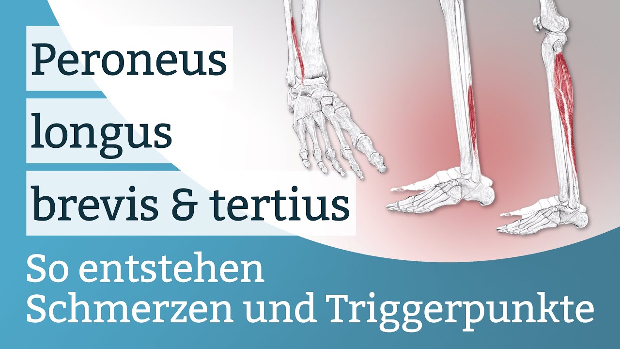 Peroneus longus, brevis & tertius Schmerzen, Triggerpunkte und deren Aktivierung