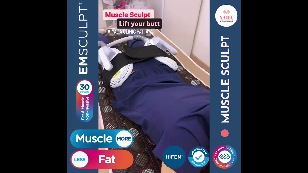 Emsculpt for booty @ Yada Clinic Pattaya