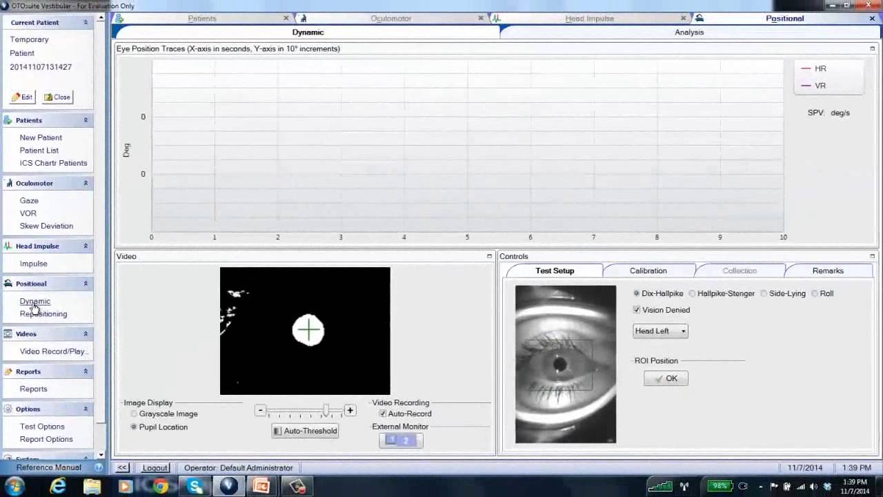 ICS Impulse - Positional Dynamic
