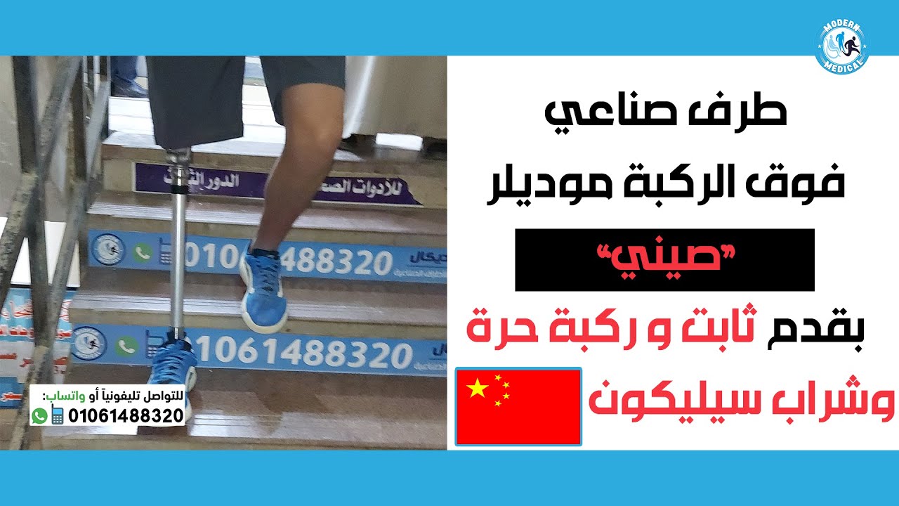 طرف صناعي فوق الركبة موديلر (صيني 🇨🇳) بشراب سيليكون امريكي و ركبة حرة  و شاتل لوك