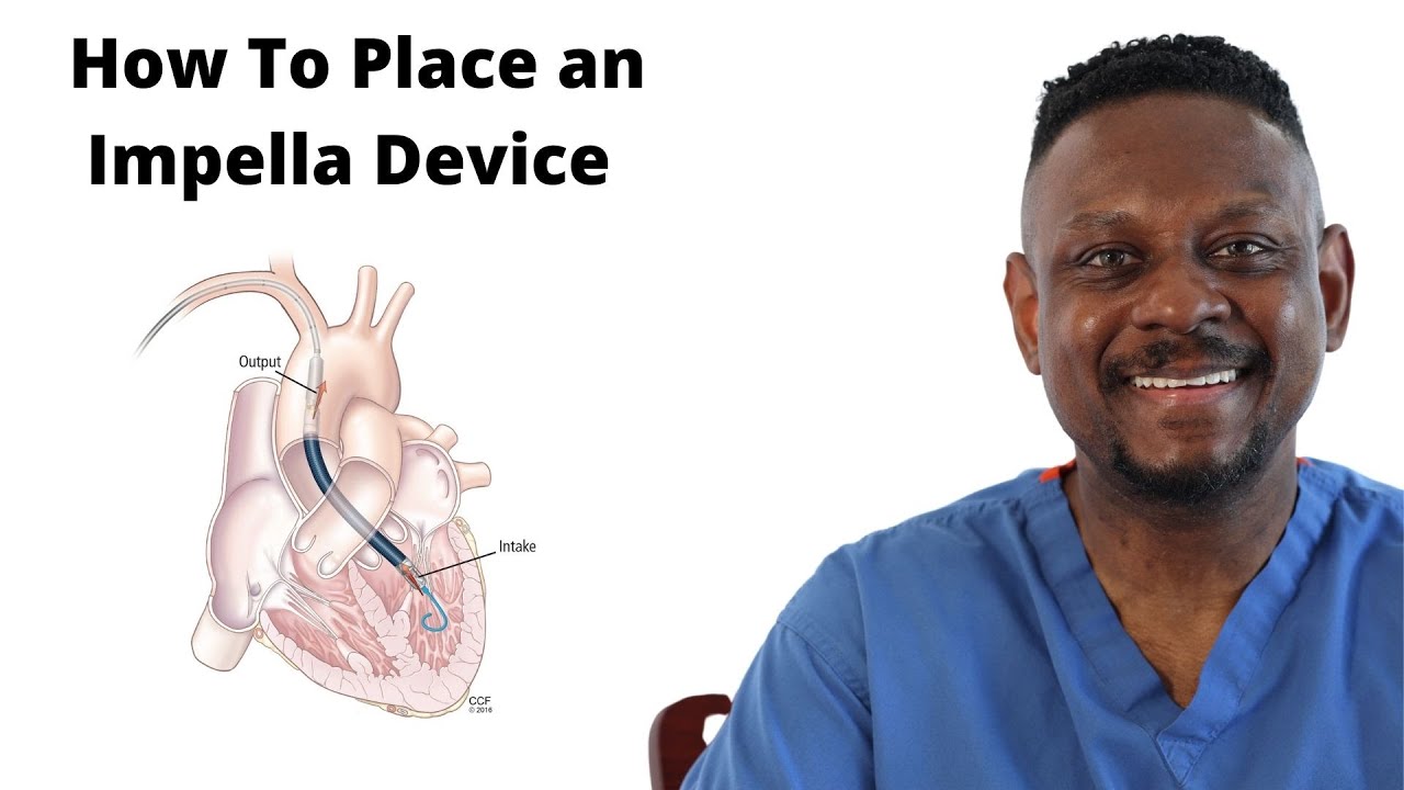 Impella Assist Device Placement