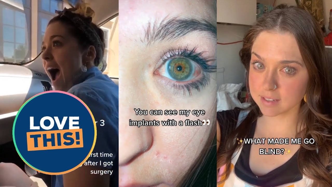 Blind woman regains her sight after surgery | SWNS