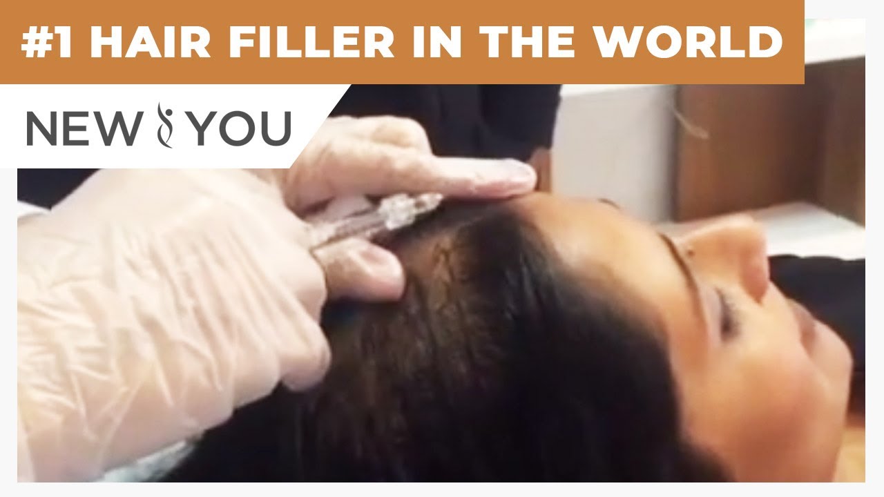 #1 HAIR FILLER IN THE WORLD | New You Med Spas