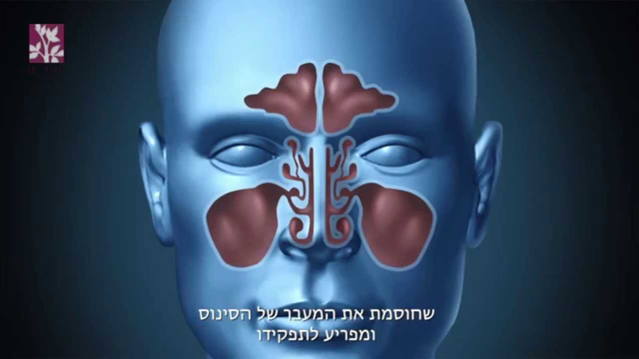 על בעיות בסינוסים