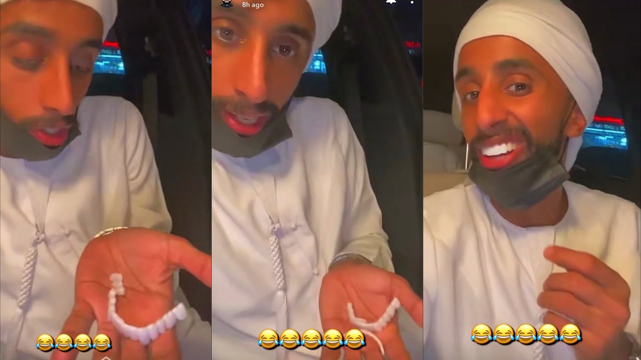 سناب عادل جمال [33] انكسر اسنان عادل جمال