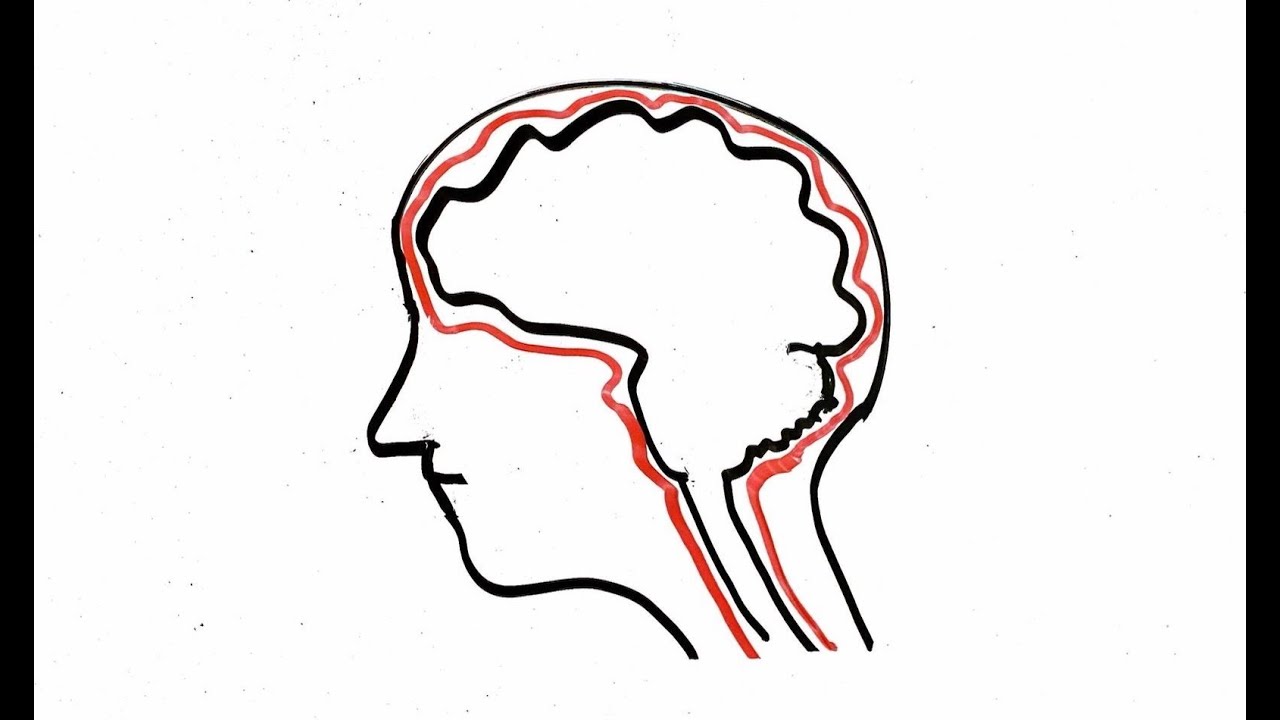MENINGITIS ASÉPTICA EN DURANGO: IMPLICACIONES