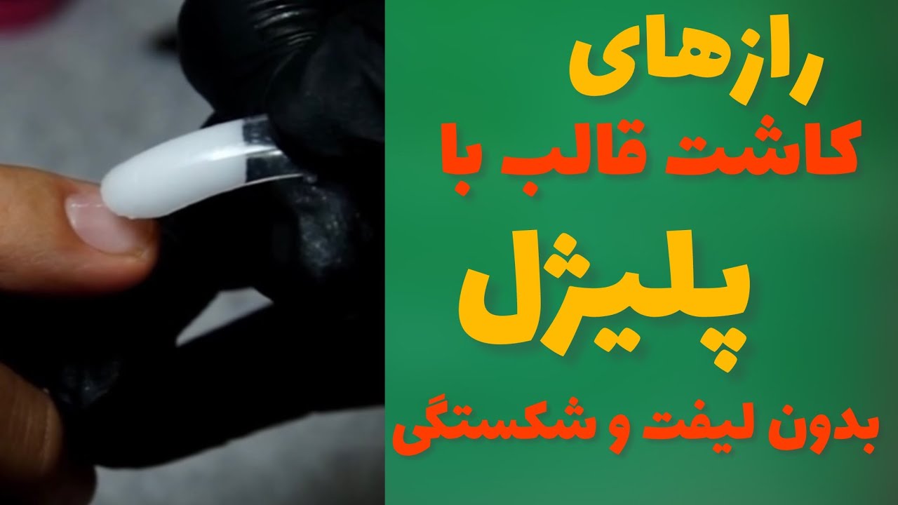 کاشت قالب با پلیژل: تک مرحله ای با تمام تکنیک ها و فوت و فن ها