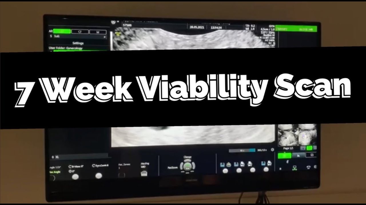 7 Week Viability Scan | Same Sex Couple IVF Journey
