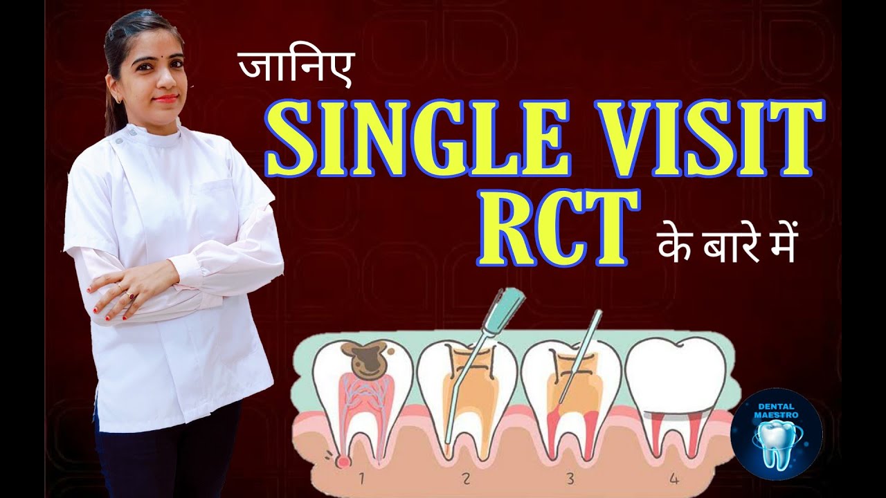 Single Visit RCT | single visit endodontics | one sitting RCT | RCT in one sitting | dental maestro