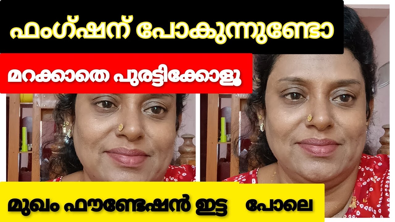 എല്ലാവരും ചോദിച്ചു മുഖം ഫേഷ്യൽ ചെയ്തോന്ന് 